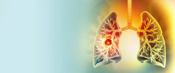 Why Your Lifestyle Needs Periodic Adjustments